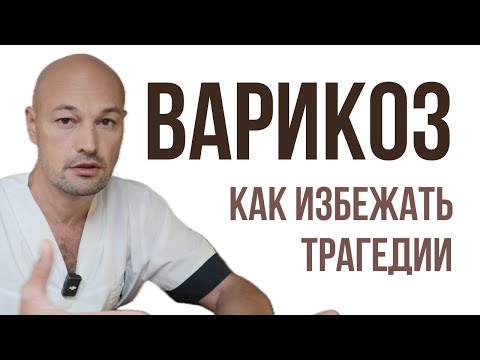 Видео: Варикоз: первые симптомы, причины и как предотвратить осложнения | Профилактика и упражнения