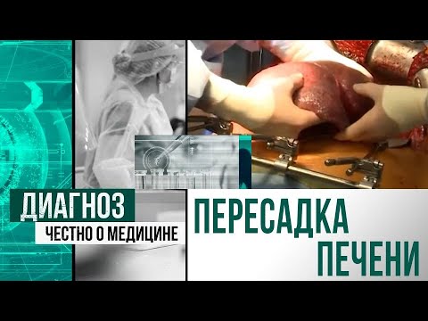 Видео: Первая трансплантация печени в Казахстане: история пациентки | Диагноз