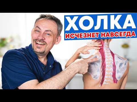 Видео: Эта ПРАКТИКА убирает ХОЛКУ НАВСЕГДА! «Удивлённый страус»