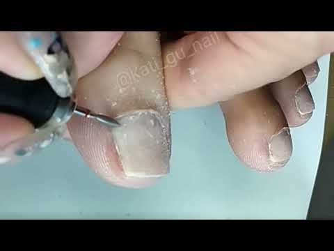 Видео: Пленки в педикюре 😱. Лайфхак😉. 2 способа крепления плёнок 🤔.#nails #nailart #ногти #педикюр #пленка