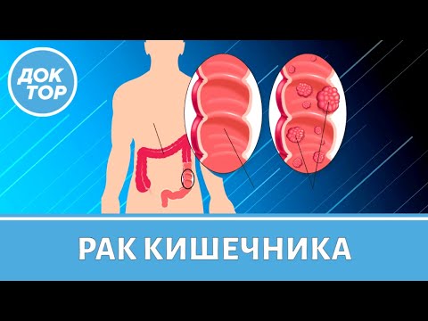 Видео: Не пропустите рак кишечника! Онколог Бадма Башанкаев отвечает на все вопросы об этой тяжелой болезни