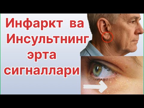 Видео: Инфаркт ва инсультнинг эрта сигналлари 