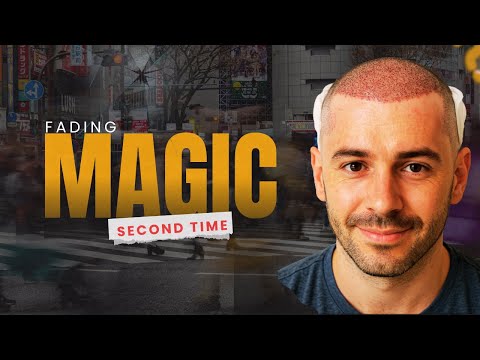 Видео: Пересадка волос | Лучшие результаты и стоимость пересадки волос #hairtransplant