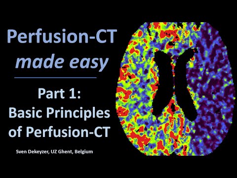 Видео: Перфузионная КТ – это просто. Часть 1. Принципы перфузионной КТ
