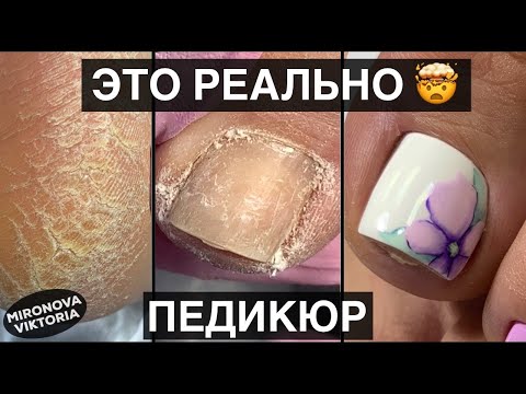 Видео: Разросшийся Гипонихий.  Провожу Эксперимент. Рисую флористику.Педикюр.