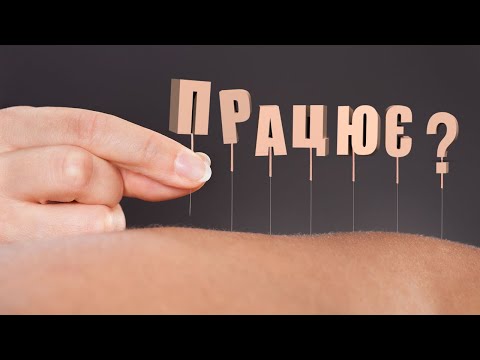 Видео: Акупунктура эффективна? Проблемы рефлексотерапии | Невідомий Автор