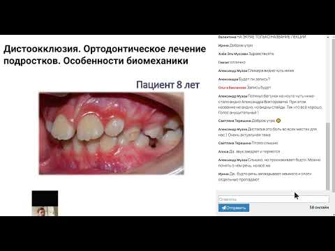 Видео: Дистоокклюзия. Ортодонтическое лечение подростков. Особенности биомеханики.