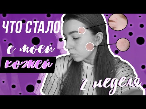 Видео: ПРОБЛЕМЫ С КОЖЕЙ||ВОДНАЯ ДИЕТА||ВТОРАЯ НЕДЕЛЯ||Oksana Portman
