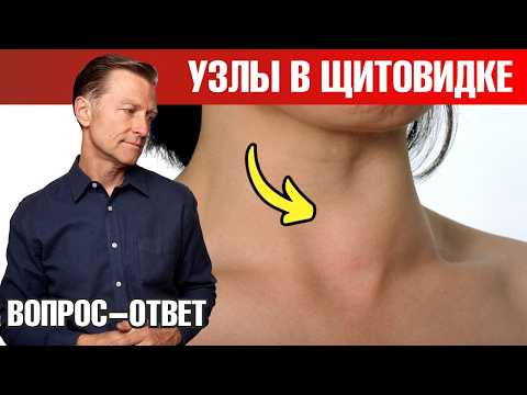 Видео: Главная причина узлов щитовидной железы🧐 Здоровье щитовидки