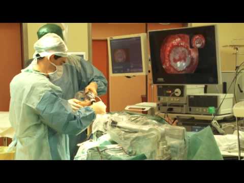 Видео: Федеральный Центр Нейрохирургии