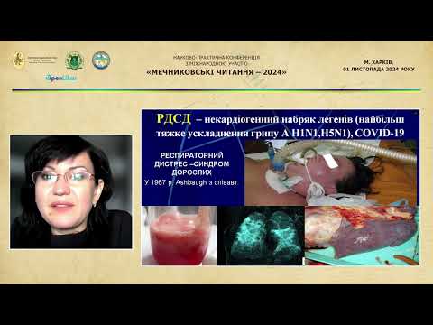 Видео: КЛ діагностика ГРВІ, сучасні аспекти етіотропного та патогенетичного лікування (Юрко К.В.)