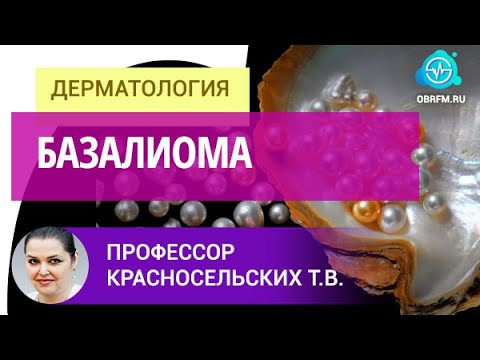 Видео: Профессор Красносельских Т.В.: Базалиома