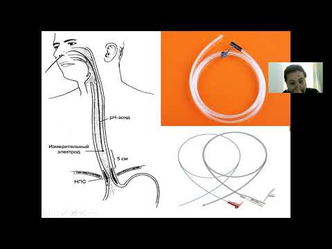 Видео: Науқастарды тамақтандыру. Жасанды тамақтандыру түрлері.