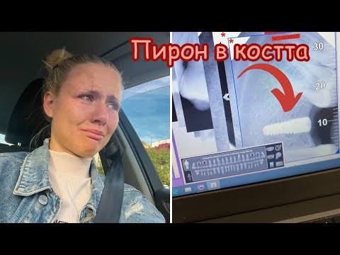 Видео: ПОСТАВЯНЕ НА ИМПЛАНТ - БОЛКА И СТРАХ 🦷