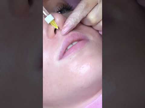 Видео: Губы бантик(1)