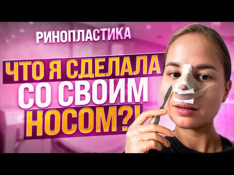 Видео: РИНОПЛАСТИКА: как меня развели врачи / как я неделю не могла дышать