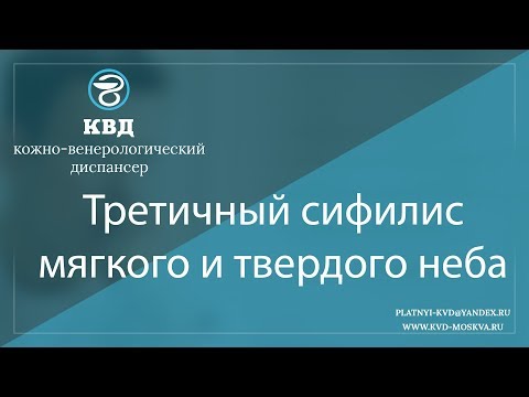 Видео: 922  Третичный сифилис мягкого и твердого неба