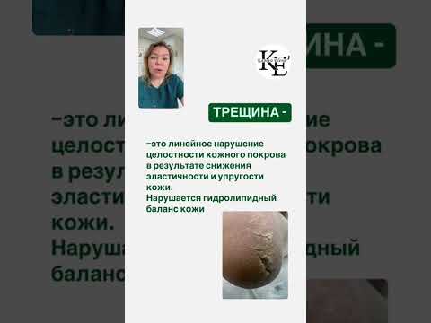 Видео: Трещины подомарафон