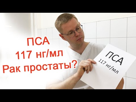 Видео: ПСА 117 нг/мл – Рак простаты? / Доктор Черепанов