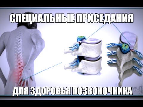 Видео: Межпозвоночные Грыжи и Протрузии - Лечим СПИНУ ПРИСЕДАНИЯМИ - СпецПриседы для Здоровой СПИНЫ