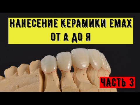 Видео: Нанесение керамики emax  на диоксид циркония каркас  Нанесение из 6 масс