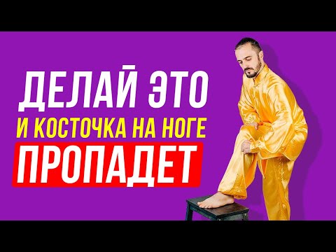 Видео: Как убрать косточку на ноге в домашних условиях? Упражнения, для лечения большого пальца ноги!