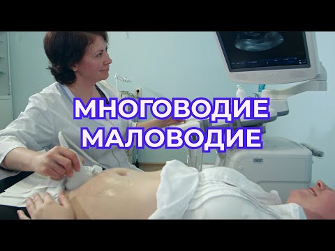 Видео: Многоводие и Маловодие при Беременности  Причины и Последствия