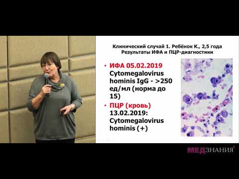 Видео: Билиарная атрезия: проведена трансплантация печени. Что ждёт врача?  Разбор клинического случая