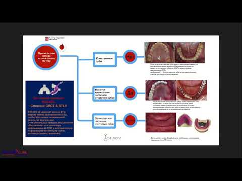 Видео: 2018 09 04  СЕДОВ Ю    Концепция хирургических шаблонов R2Gate  Сложное просто