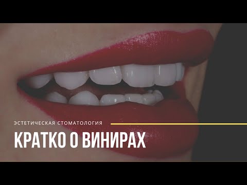 Видео: Виниры: за и против (керамика, композит, люминиры). Владимир Ордовский-Танаевский