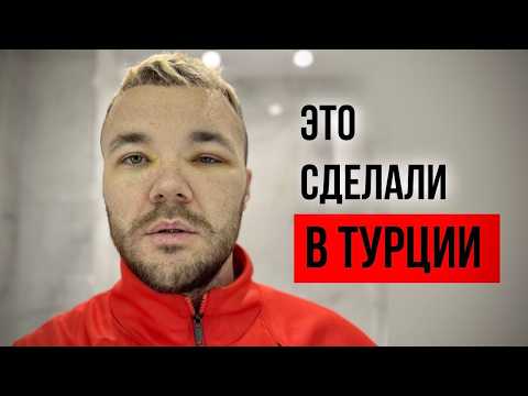 Видео: Пересадка волос в Турции. Моё путешествие в боль / СТАМБУЛ