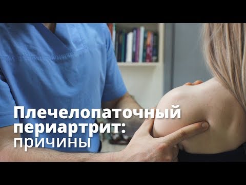 Видео: Причины плечелопаточного периартрита