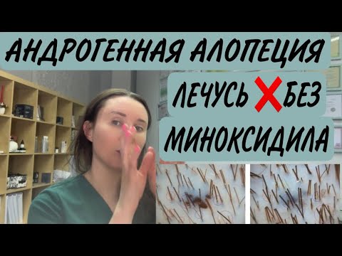 Видео: У меня АГА. Без миноксидила. Алопеция. Трихолог. Фототрихограмма.