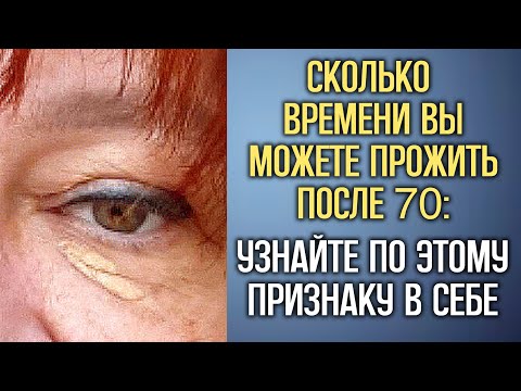 Видео: 7 признаков, предсказывающих, как долго вы проживёте после 70 лет — НАУЧНО ДОКАЗАНО!