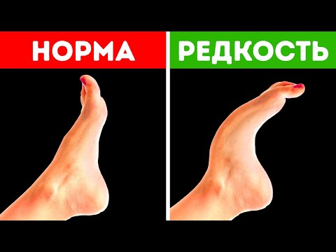 Видео: Этой особенностью обладают только 8 % людей + еще 17 редких особенностей тела