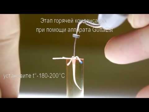 Видео: Гибридная методика обтурации корневых каналов
