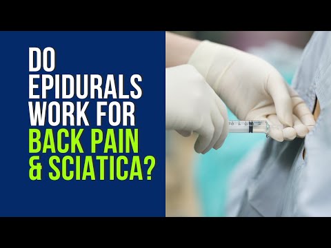 Видео: Помогает ли эпидуральная анестезия при болях в спине и ишиасе?