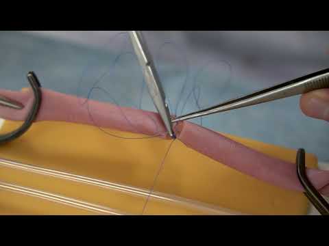 Видео: ПСА Сосудистый шов