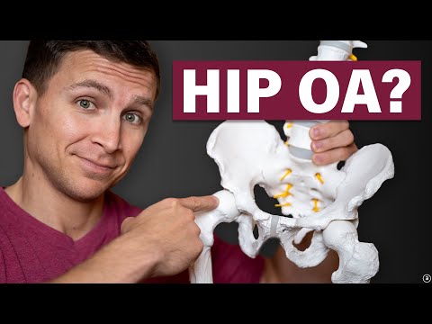 Видео: Врач-физиотерапевт отвечает на 10 самых частых вопросов об остеоартрите тазобедренного сустава