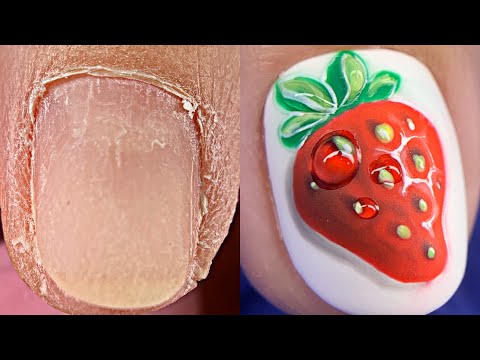 Видео: ЗАТЕКИ Как убрать?🤔Очень сухая кутикула😕Дизайн ногтей клубничка