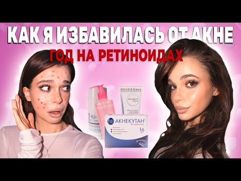 Видео: ГОД НА АКНЕКУТАНЕ / Как я добилась идеальной кожи