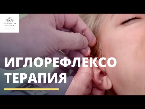 Видео: Иглорефлексотерапия