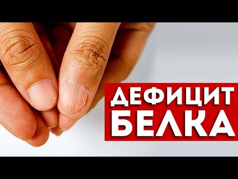 Видео: 7 признаков дефицита белка, которые нельзя игнорировать