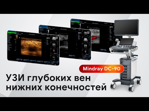 Видео: Мастер-класс по УЗИ глубоких вен нижних конечностей на Mindray DC-90