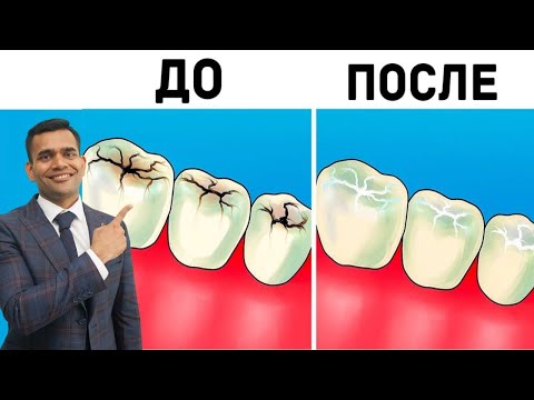 Видео: Естественный Способ Отбеливания Зубов В Домашних Условиях