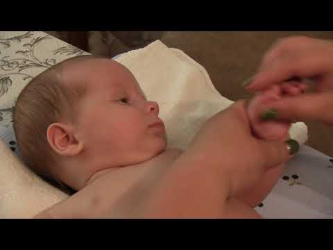 Видео: № 85 Лечебный массаж при синдроме тонусных нарушений( гипертонусе)