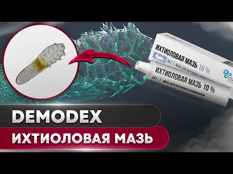 Видео: Ихтиоловая мазь против клеща | Угревая Железница Demodex