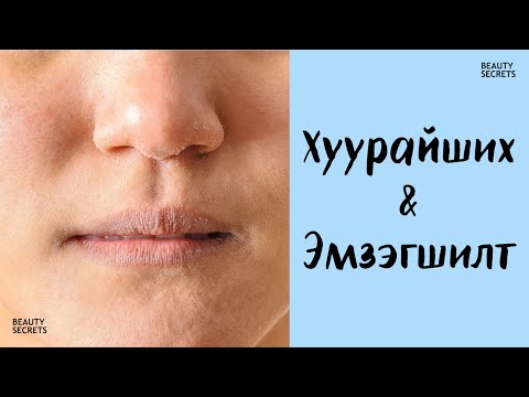 Видео: Арьс арчилгааны анхан шатны хичээл #6: Хуурайшилт ба эмзэгшилт