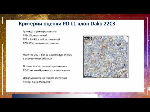 Видео: Определение статуса PD-L1 при немелкоклеточном раке легкого