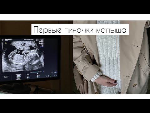 Видео: 18-АЯ НЕДЕЛЯ БЕРЕМЕННОСТИ | ДНЕВНИК БЕРЕМЕННОСТИ | ПЕРВЫЕ ПИНОЧКИ МАЛЫША